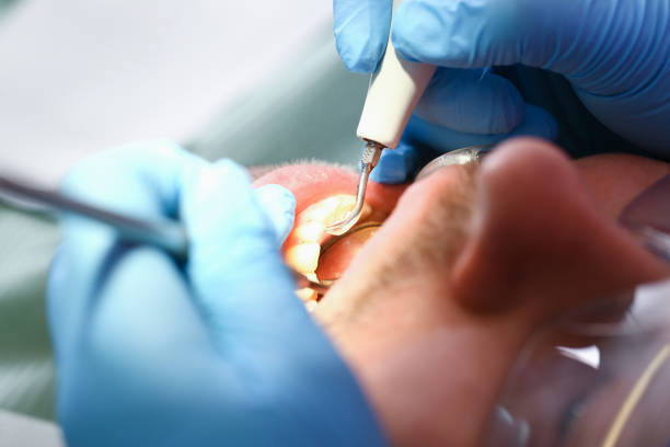 Best Chipped Tooth Repair Near Me  in Upper Brookville, NY